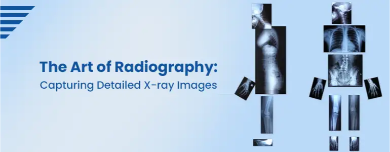 The Art of Radiography: Capturing Detailed X-ray Images