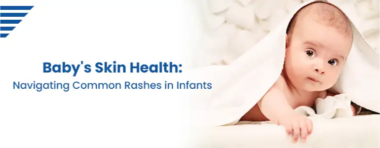 Baby's Skin Health: Navigating Common Rashes in Infants