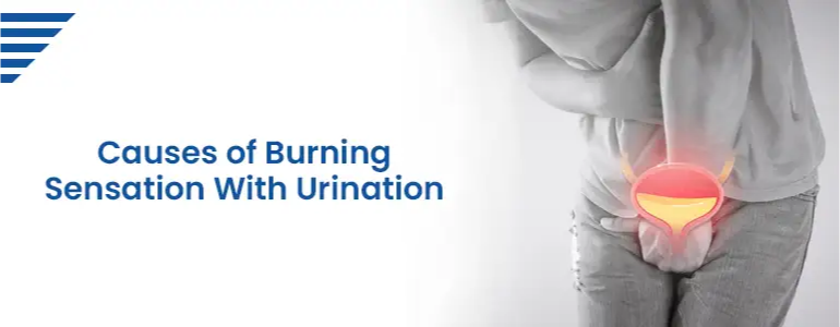 causes-of-burning-sensation-with-urination