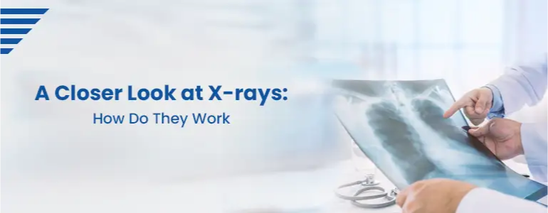 A Closer Look at X-rays: How Do They Work?