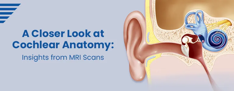 >A Closer Look at Cochlear Anatomy: Insights from MRI Scans