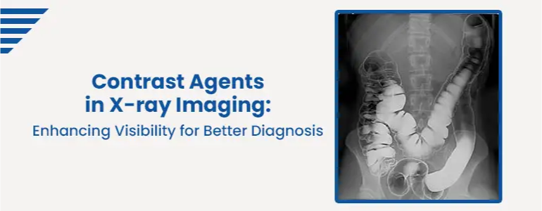 Contrast Agents in X-ray Imaging: Enhancing Visibility for Better Diagnosis