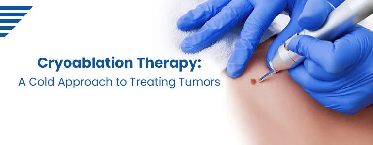 Cryoablation Therapy: A Cold Approach to Treating Tumors