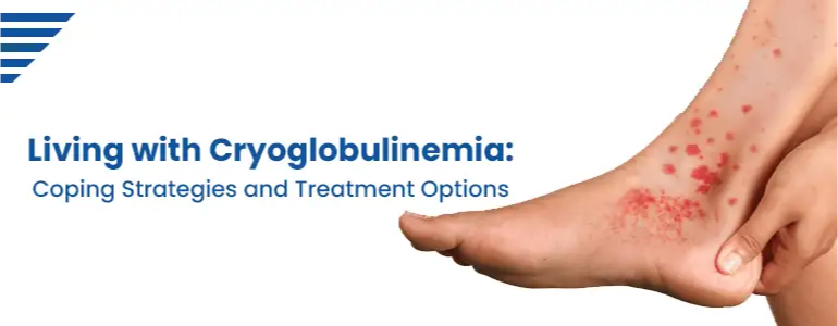 Living with Cryoglobulinemia: Coping Strategies and Treatment Options