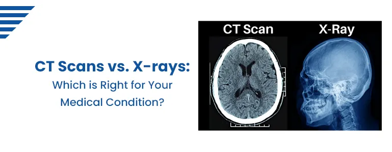 CT Scans vs. X-rays: Which is Right for Your Medical Condition