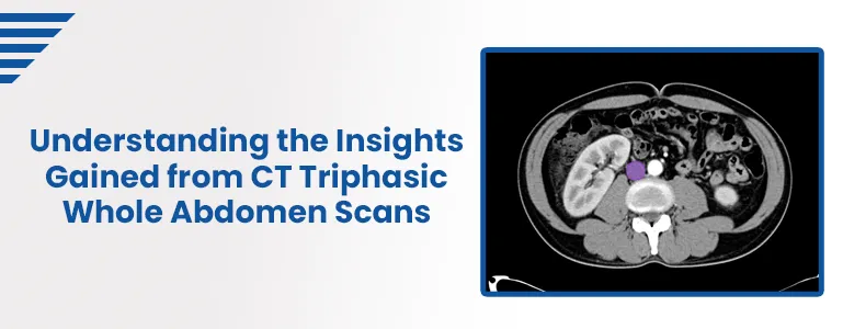 Understanding the Insights Gained from CT Triphasic Whole Abdomen Scans