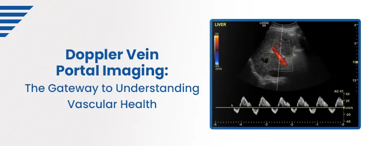 Doppler Vein Portal Imaging: The Gateway to Understanding Vascular Health