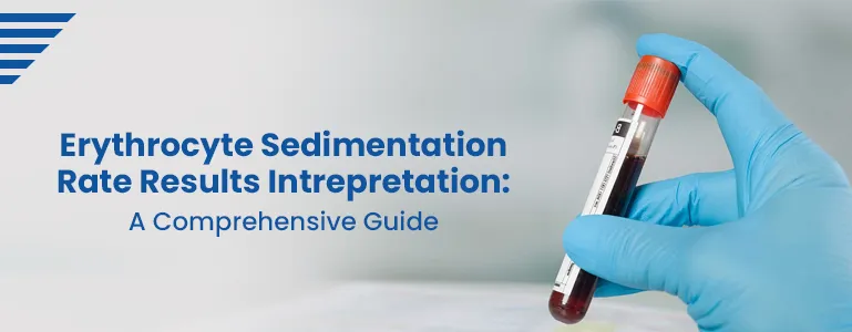 Erythrocyte Sedimentation Rate Results Intrepretation : A Comprehensive Guide