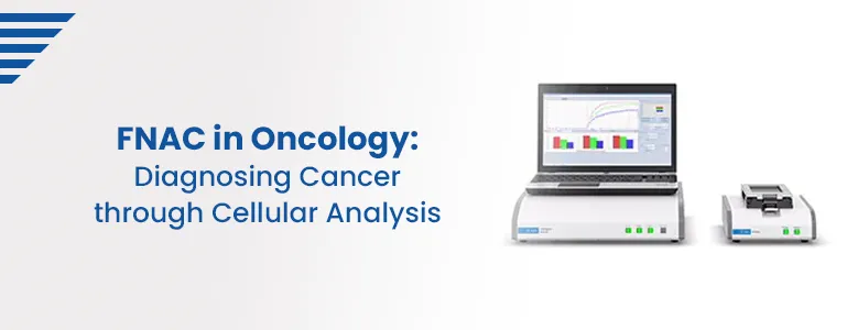 FNAC in Oncology: Diagnosing Cancer through Cellular Analysis