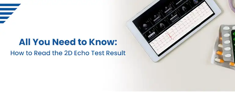 how-to-read-the-2d-echo-test-result