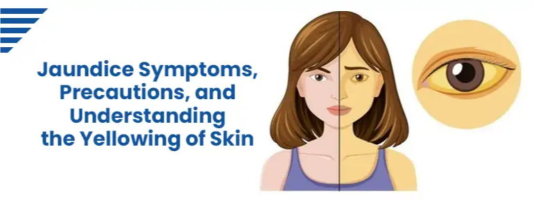 Jaundice  Symptoms, Precautions, and Understanding the Yellowing of Skin