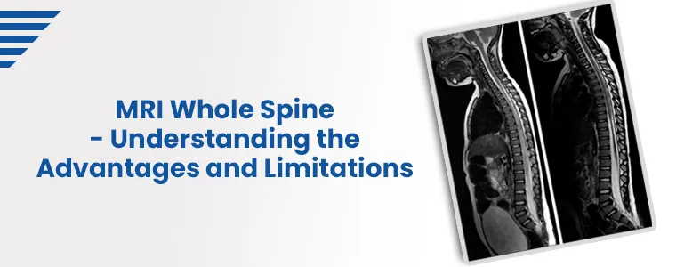 MRI Whole Spine - Understanding the Advantages and Limitations