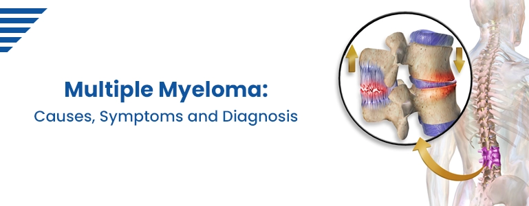 Multiple Myeloma: Causes, Symptoms and Diagnosis