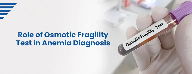 osmotic-fragility-test-role-anemia-diagnosis