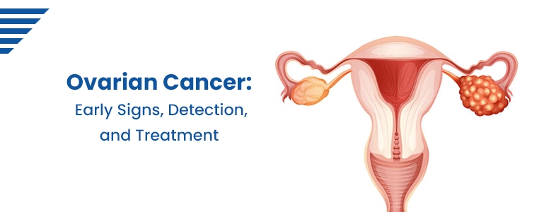 ovarian-cancer-early-signs-detection-and-treatment