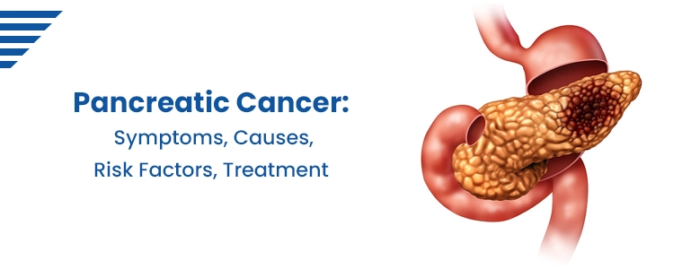 pancreatic-cancer-symptoms-causes-risk-factors-treatment