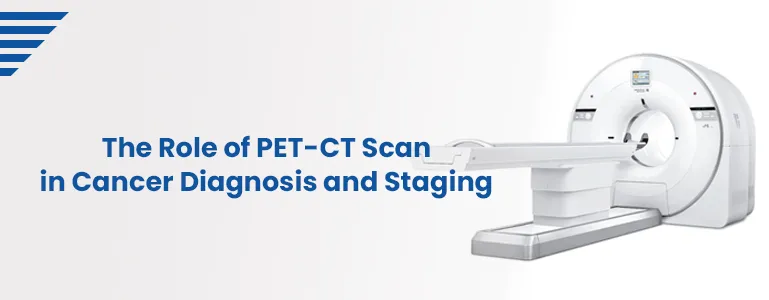 The Role of PET-CT Scan in Cancer Diagnosis and Staging