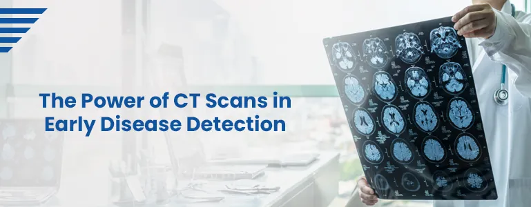 The Power of CT Scans in Early Disease Detection