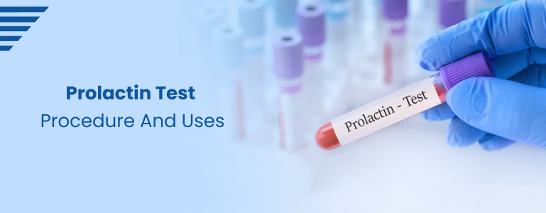 Prolactin Test Procedure and Uses