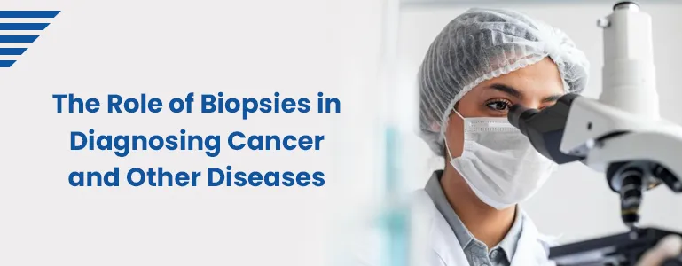 The Role of Biopsies in Diagnosing Cancer and Other Diseases