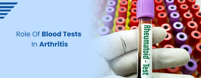 Role of Blood Tests in Arthritis