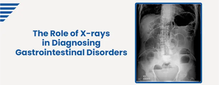 The Role of X-rays in Diagnosing Gastrointestinal Disorders