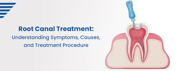 Root Canal Treatment: Understanding Symptoms, Causes, and Treatment Procedure