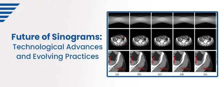 Sinograms: Technological Advances and Evolving Practices