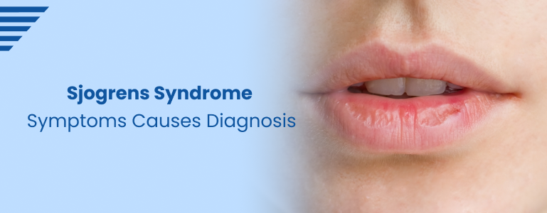 Sjögren's Syndrome: Symptoms, Causes, and Diagnosis