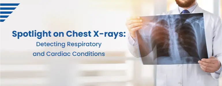 Spotlight on Chest X-rays: Detecting Respiratory and Cardiac Conditions