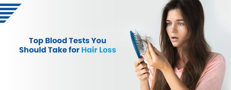 Blood Tests for Hair Loss