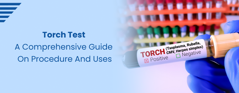 torch-test-a-comprehensive-guide-on-procedure-and-uses