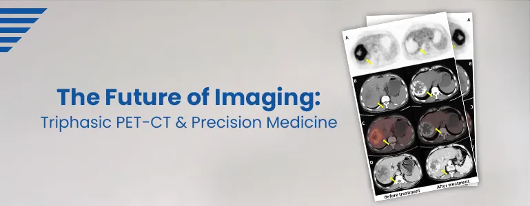 >The Future of Imaging: Triphasic PET-CT and Precision Medicine