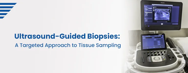 Ultrasound-Guided Biopsies: A Targeted Approach to Tissue Sampling