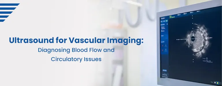 Ultrasound for Vascular Imaging: Diagnosing Blood Flow and Circulatory Issues