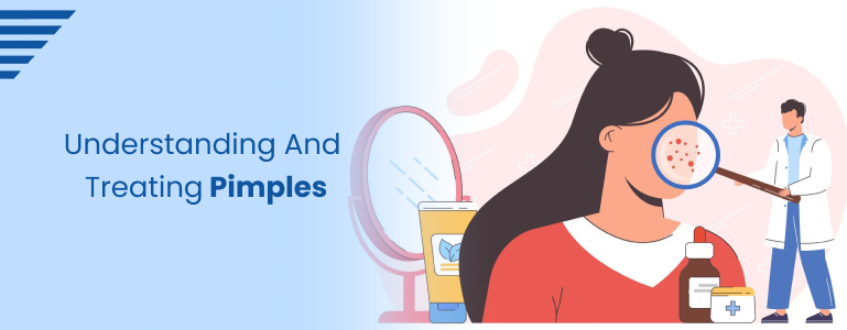 Understanding and Treating Pimples