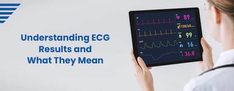 understanding-ecg-results-and-what-they-mean