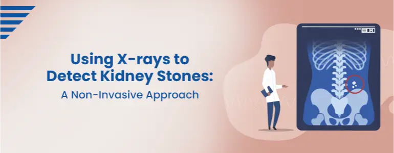 Using X-rays to Detect Kidney Stones: A Non-Invasive Approach