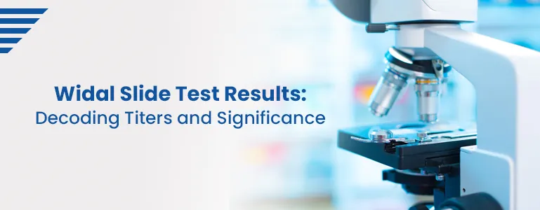 >Widal Slide Test Results: Decoding Titers and Significance