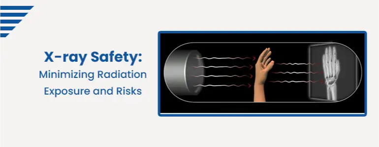 X-ray Safety: Minimizing Radiation Exposure and Risks