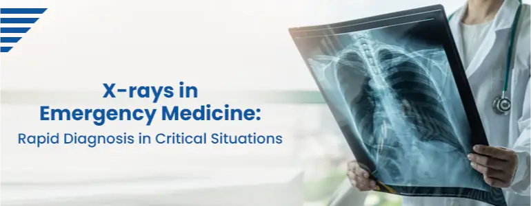 X-rays in Emergency Medicine: Rapid Diagnosis in Critical Situations