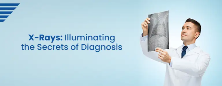 X-Rays: Illuminating the Secrets of Diagnosis