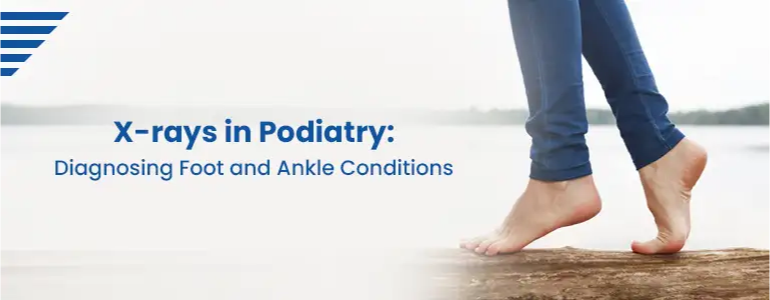 X-rays in Podiatry: Diagnosing Foot and Ankle Conditions