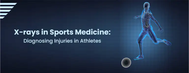 X-rays in Sports Medicine: Diagnosing Injuries in Athletes