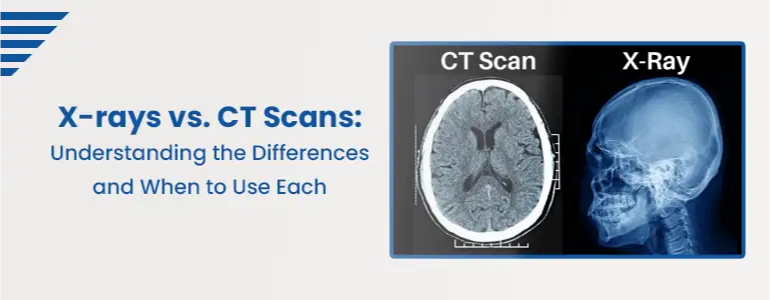 X-rays vs. CT Scans: Understanding the Differences and When to Use Each