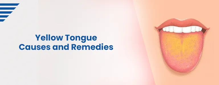 yellow-tongue-causes-and-remedies