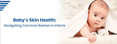 Baby's Skin Health: Navigating Common Rashes in Infants