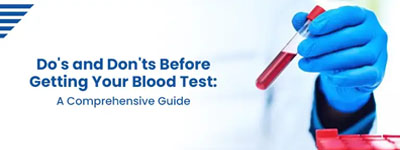 Do's and Don'ts Before Getting Your Blood Test: A Comprehensive Guide