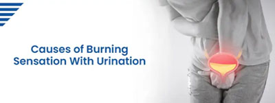 Causes of Burning Sensation With Urination