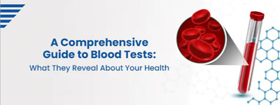 A Comprehensive Guide to Blood Tests: What They Reveal About Your Health